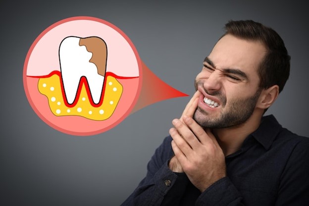 Gum Disease