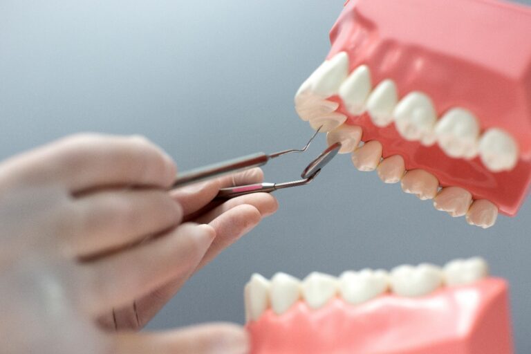 Dental Crowns