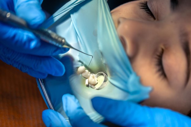 Protect Damaged Teeth