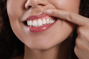 Healthy gums