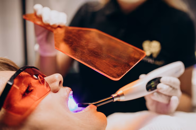 Professional teeth whitening
