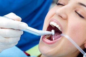 What Is Deep Teeth Cleaning? A Guide to Scaling and Root Planing for Gum Disease