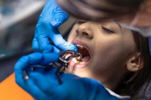 What to Expect During and After Extraction