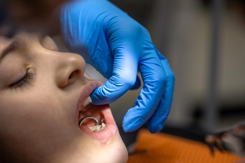 When Does a Tooth Need to Be Extracted? 7 Signs an Extraction May Be Necessary